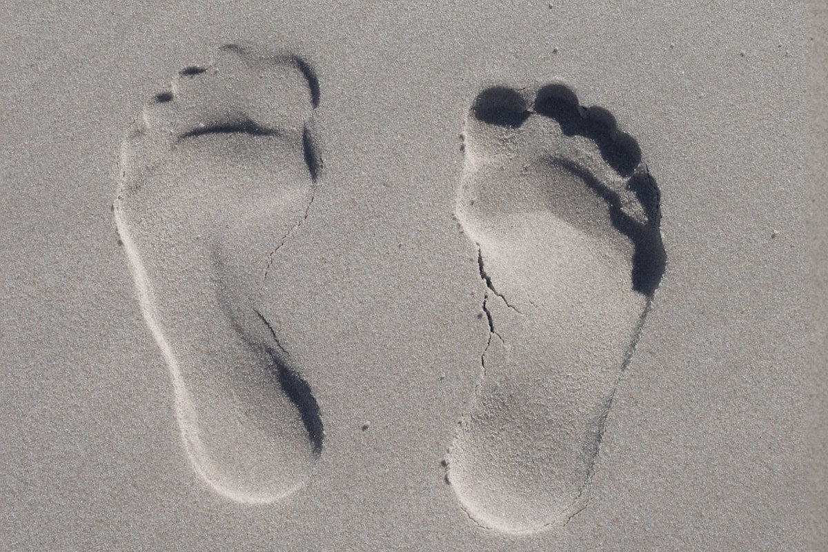 Why Do Feet Swell in Hot Weather? Causes, Remedies and Expert Tips
